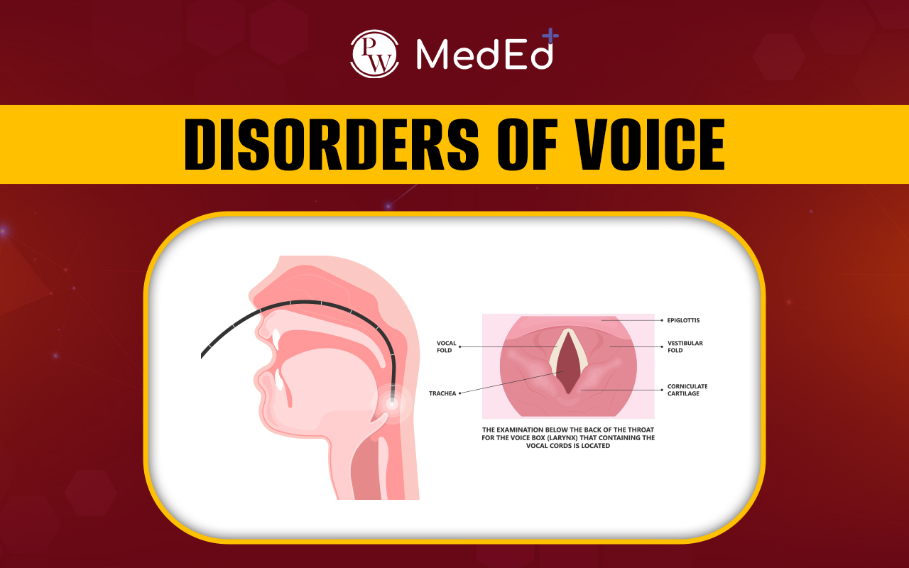 Disorders of Voice