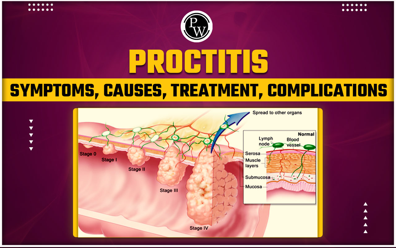 Proctitis