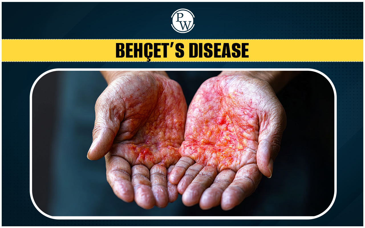Beh et s Disease Causes Risk Factor Symptoms