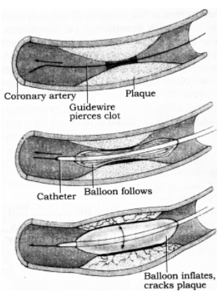 Therapeutic Instruments