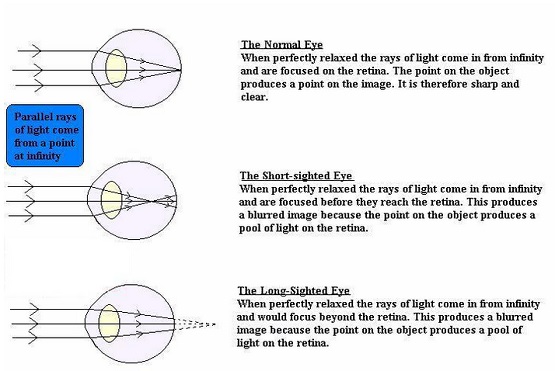STRUCTURE AND WORKING OF HUMAN EYE