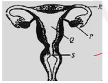 Refer to the given figure of human female reproductive system where P, Q, R and S are the locations that are affected by different birth control measures.