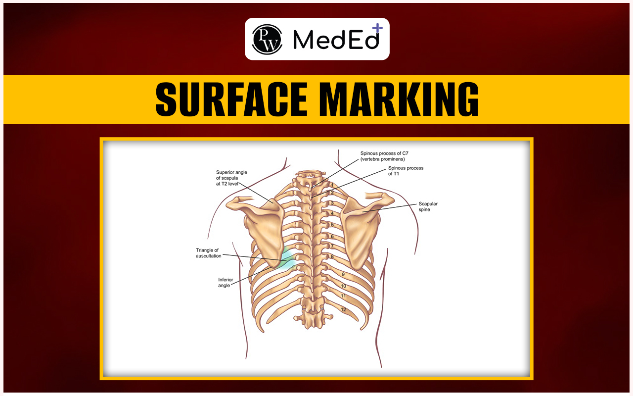 Surface Marking