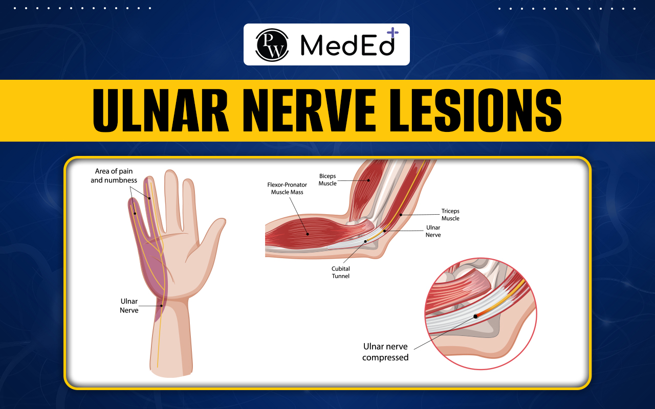 Ulnar Nerve Lesions