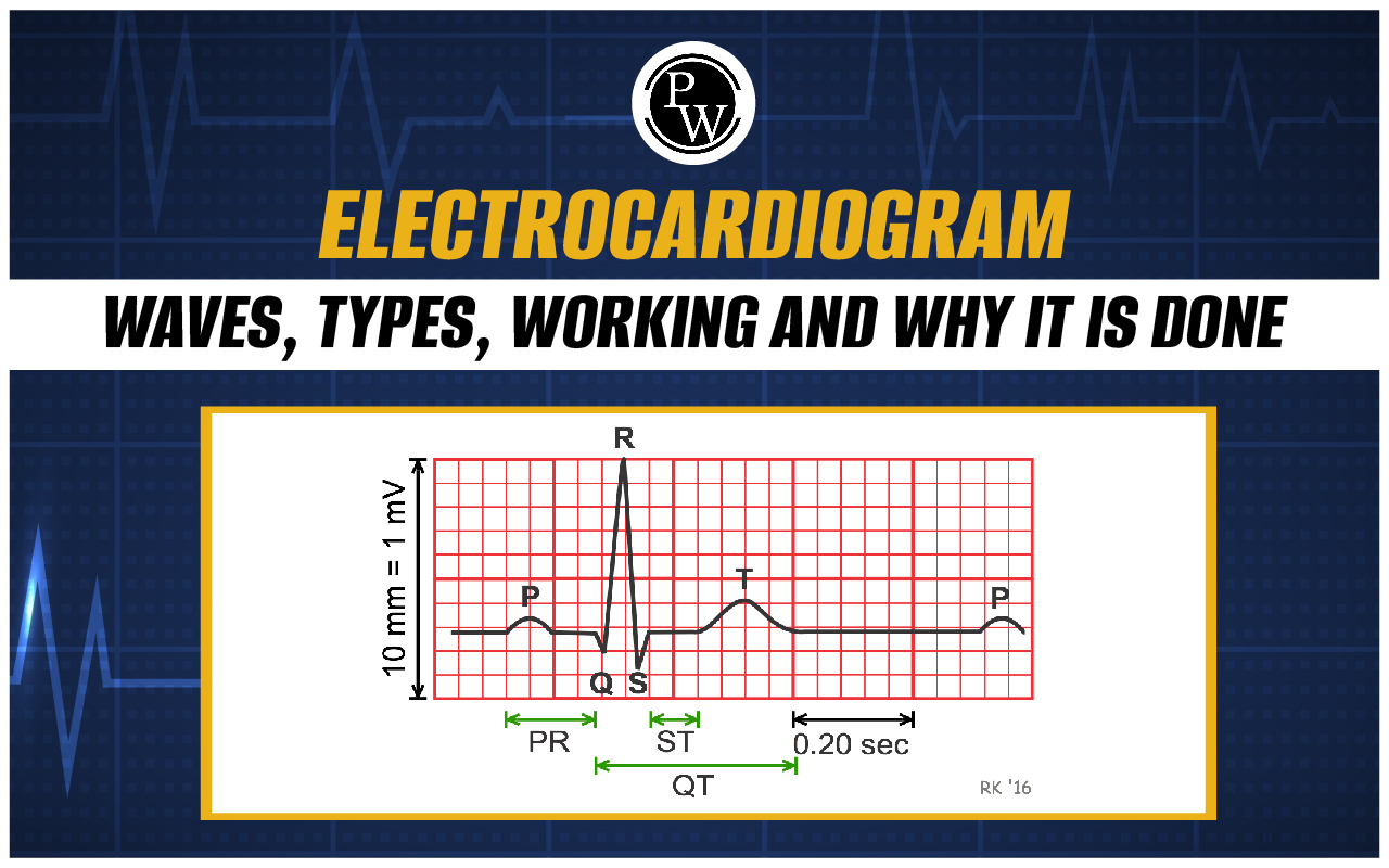 Electrocardiogram