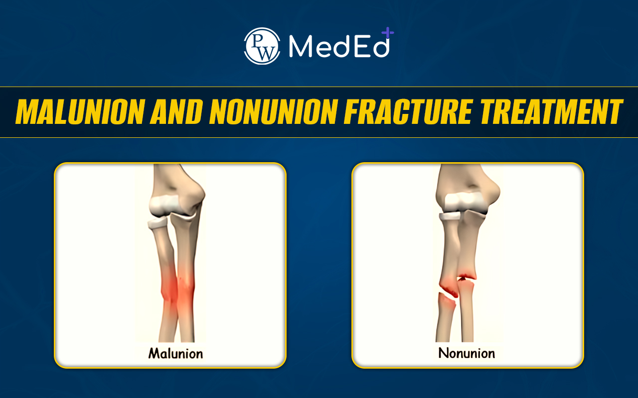 Malunion and Nonunion Fracture Treatment