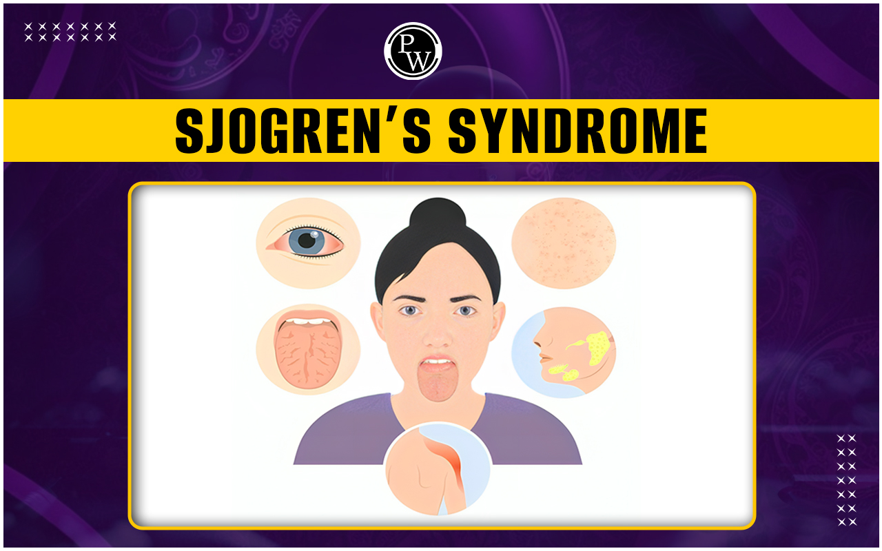 Sjogren's Syndrome Symptoms, Causes, Diagnosis, and Treatment