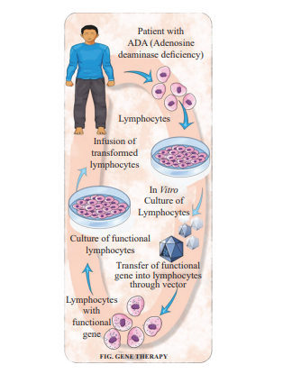 Gene Therapy 