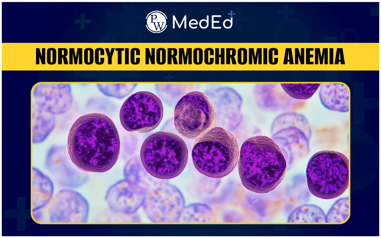 Normocytic Normochromic Anemia