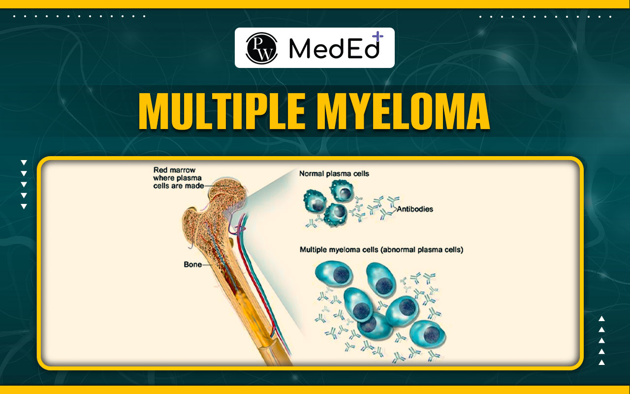 Multiple Myeloma: Etiology, Pathophysiology