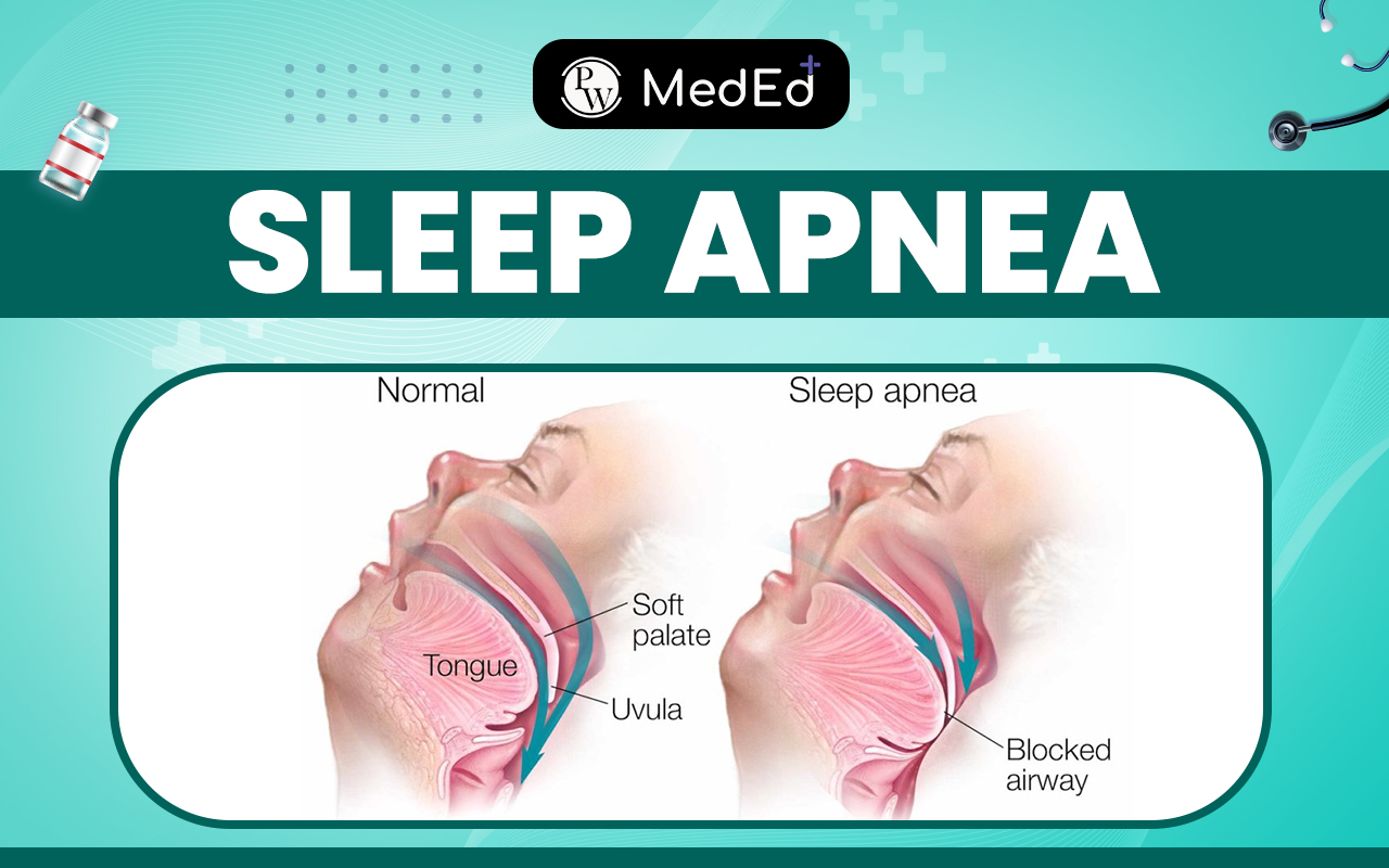 Sleep Apnea Types, Causes, Symptoms, And Treatment