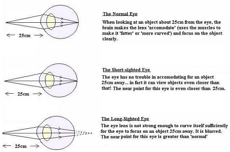 STRUCTURE AND WORKING OF HUMAN EYE