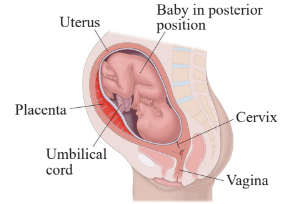 Diagrammatic view of birth canal