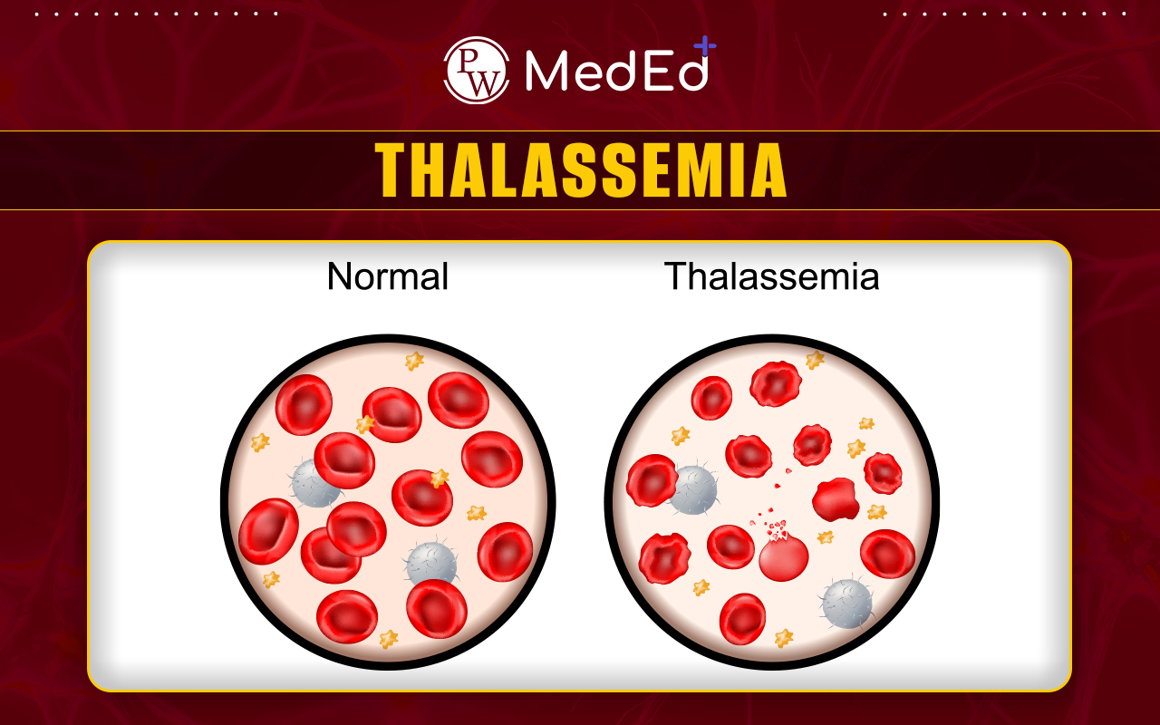 Thalassemia