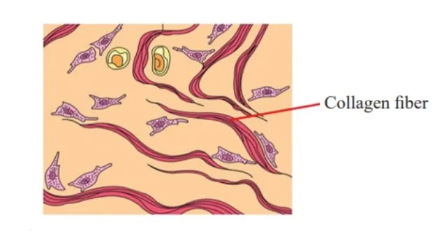 Dense Irregular Connective Tissue