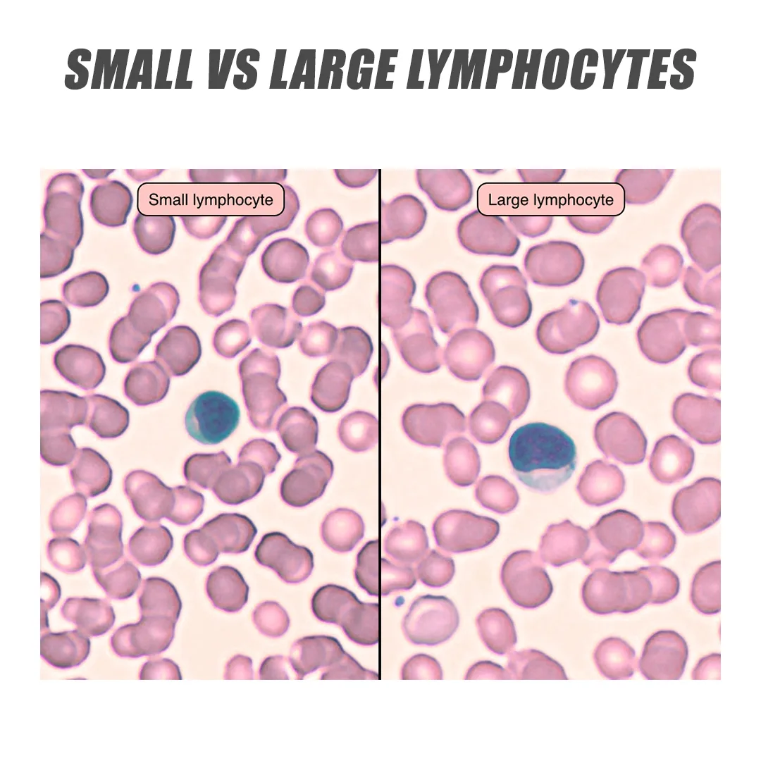 Lymphocytes Diagram