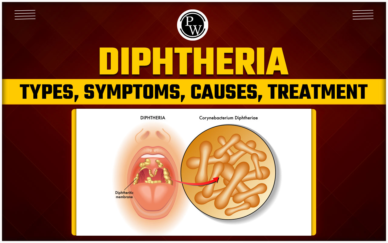Diphtheria