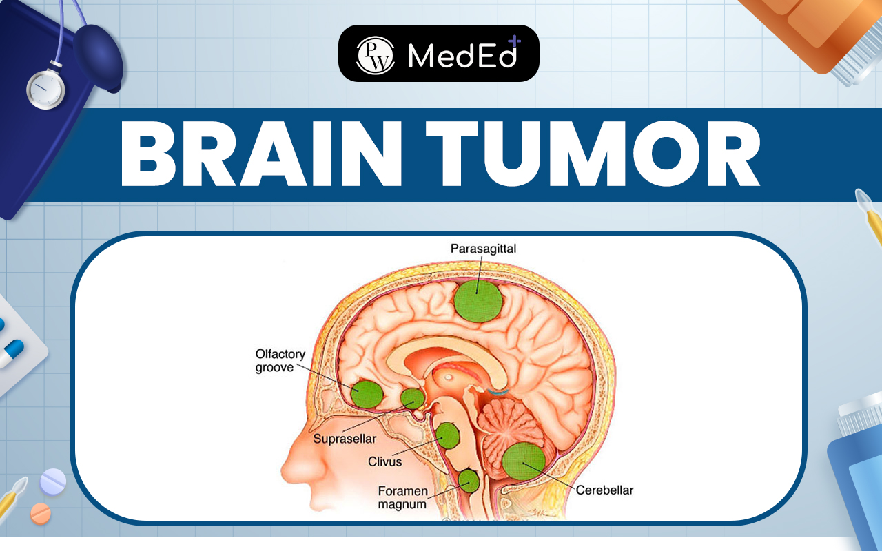 Brain Tumor Types, Causes, Symptoms, And Treatment