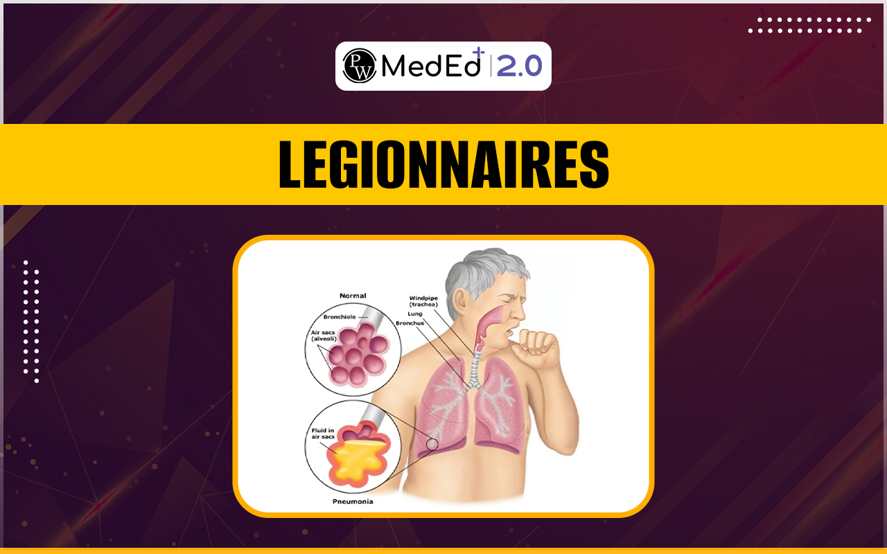 Legionnaires