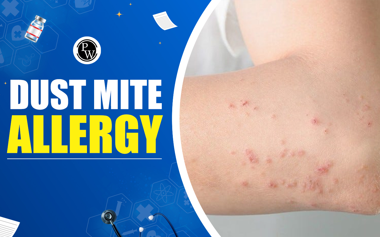 Dust Mite Allergy: Symptoms, Complications, and Treatment