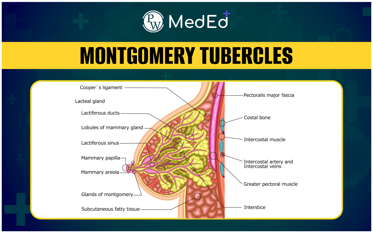 Montgomery Tubercles Appearance Causes Montgomery Tubercles Appearance Causes