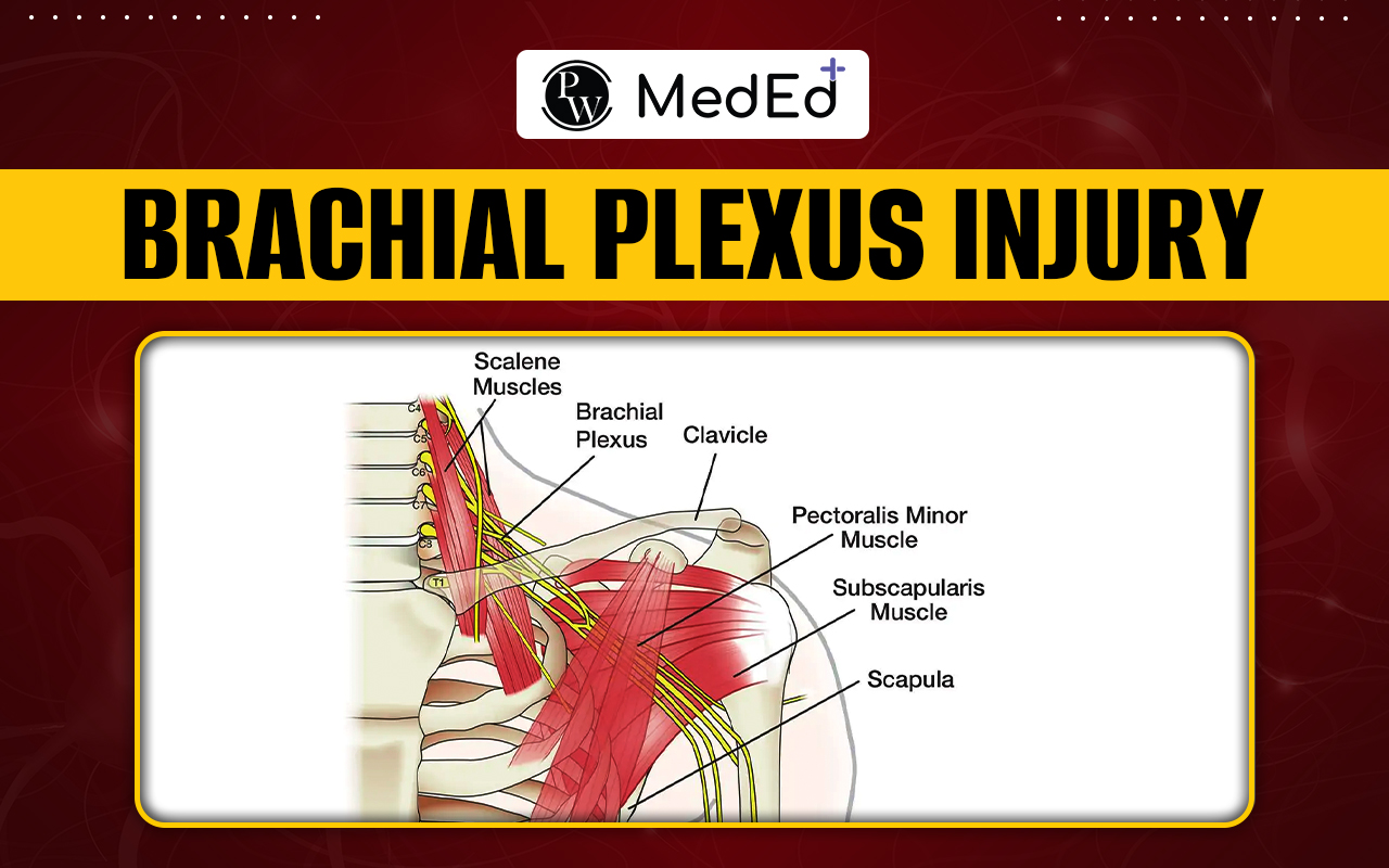 Brachial Plexus Injury