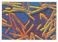 tobacco mosaic