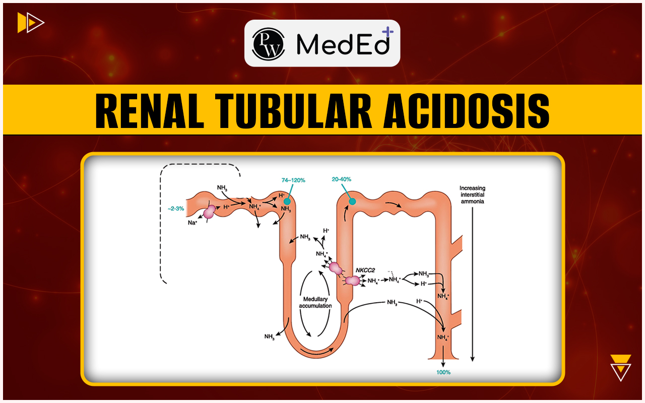 Renal Tubular Acidosis Types, Causes, Symptoms, And Diagnosis