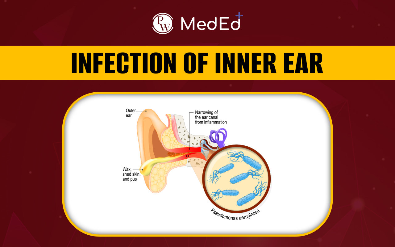 Infection Of Inner Ear