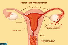 menstrual