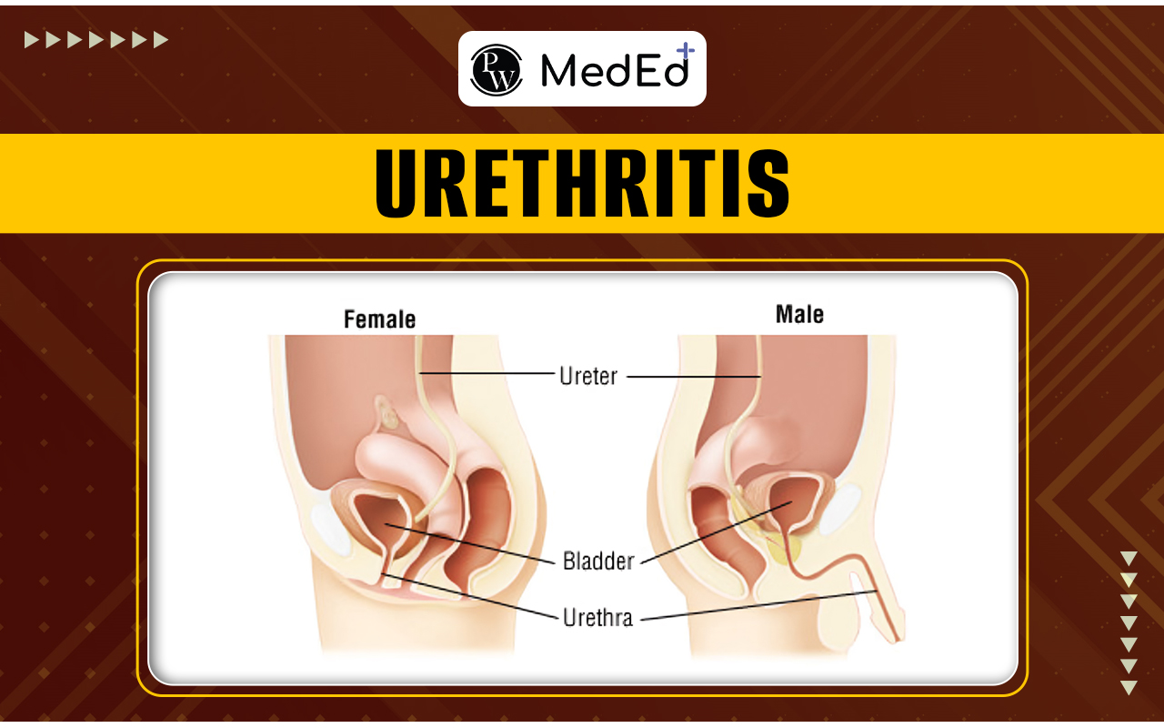 Urethritis Causes, Symptoms, Risk Factors, And Treatment
