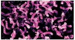 spiral bacteria