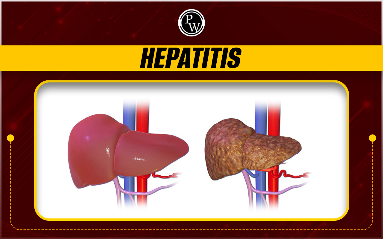 Hepatitis